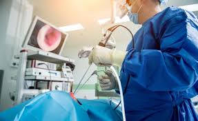 fungsi endoscopy