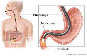 gastrointestinal endoscopy