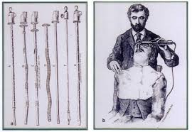 history of endoscopy